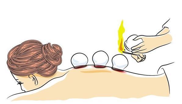 玄元妙谷科普:秋季拔火罐,小病不求人_腾讯新闻