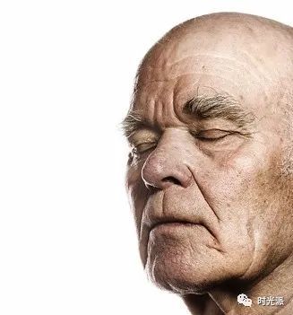 吃糖一口,加速变丑——皮肤糖化与抗糖饮食