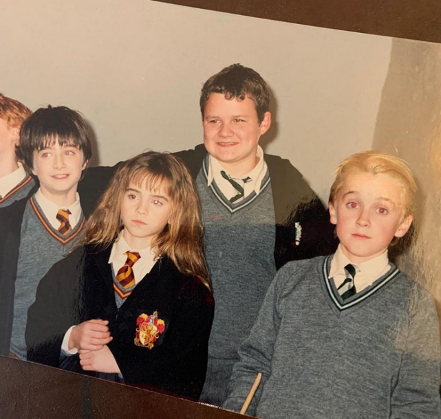 哈利波特马尔福近照曝光头发稀疏一脸油腻医生断言40岁将全秃