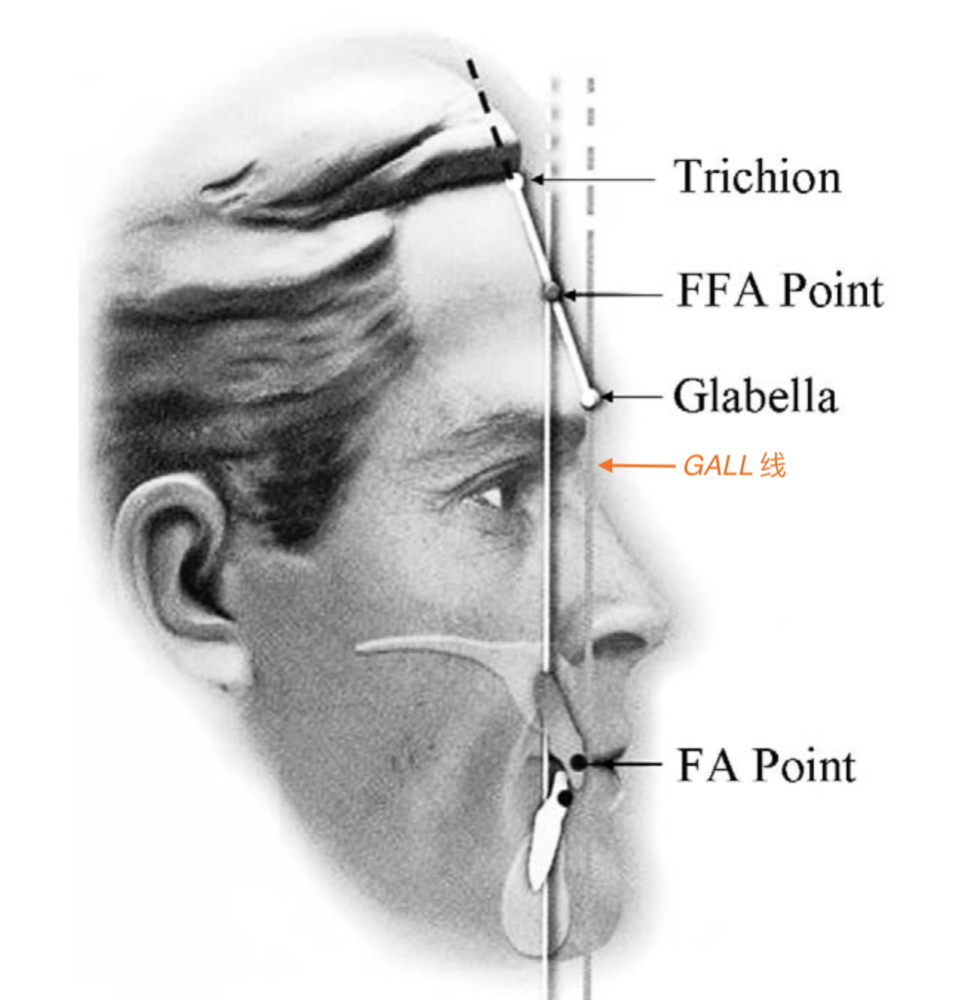 做眶耳平面的垂线,上下嘴唇最突的点和颏点应落在此线上