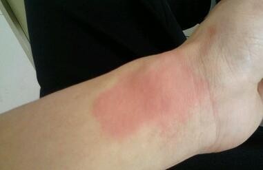 贺兰山近2000人组团抓蝎子每天几百斤暴利下面隐藏什么危机