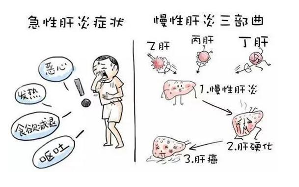 了解肝炎的原因2,急性无黄疸型肝炎患者常表现为低热,这主要是因为