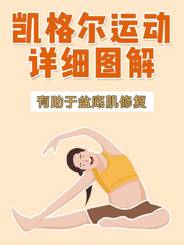 孕期产后修复|准妈必做凯格尔运动详解