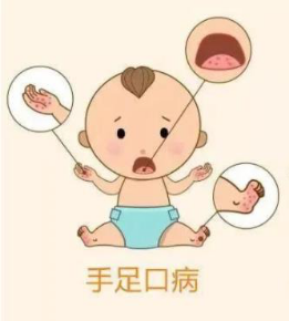 手足口病高发期警惕传染病来袭