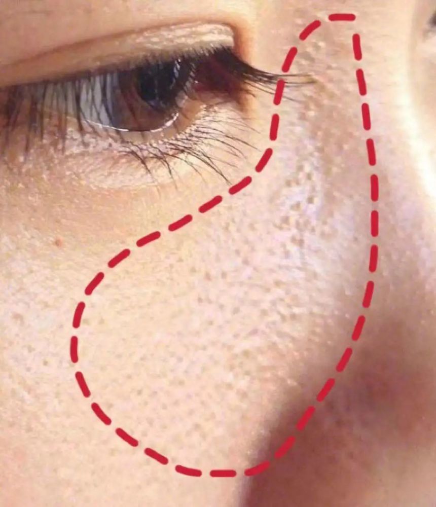 关于鸡皮肤和环境有关系么的信息