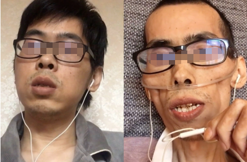 抗癌网红去世已瘦到皮包骨曾被质疑骗取打赏