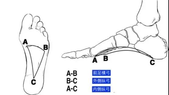 人到中年足弓就渐渐塌了一个脚印看出足弓高低