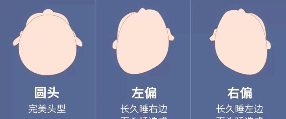 但是成人的颅骨已经基本发育成型,只能靠发型缓解了.