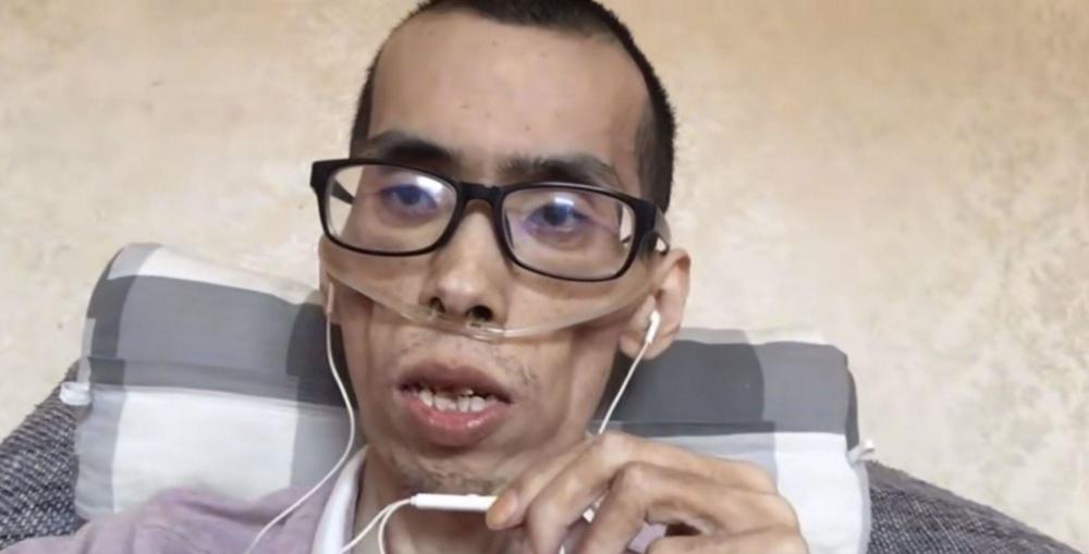 又一憾事!抗癌网红阿健去世,遗照和去世前瘦成皮包骨判若两人