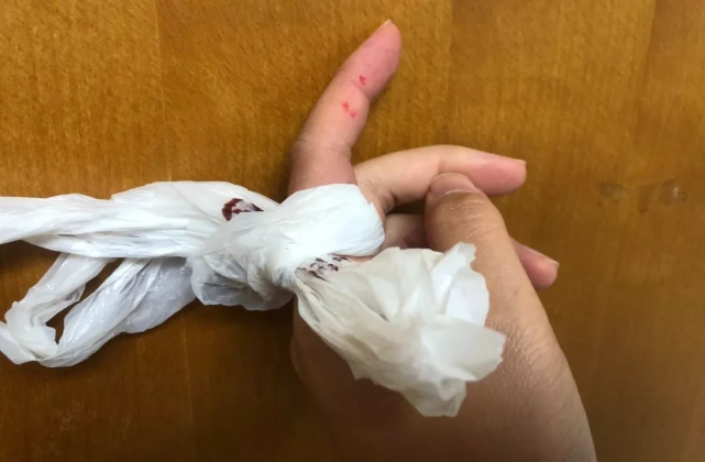 蛇头突然暴起,咬伤老板娘的手指并流血