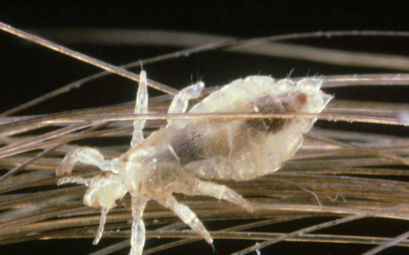 30年前还和人类共生的虱子为啥如今不见了是灭绝了吗