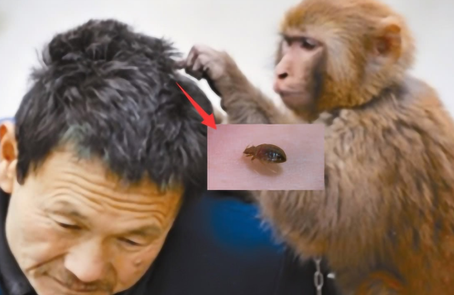 30年前还和人类共生的虱子为啥如今不见了是灭绝了吗