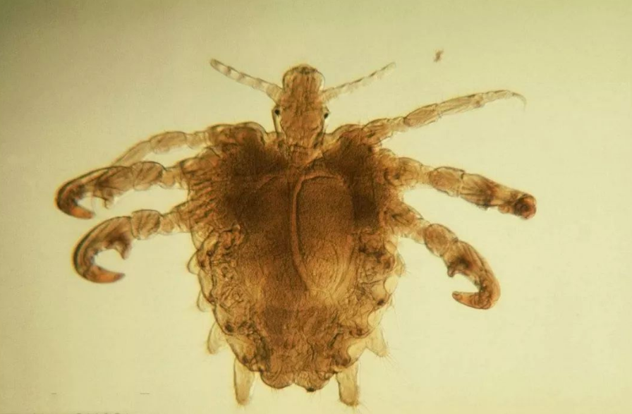 30年前还和人类共生的虱子为啥如今不见了是灭绝了吗