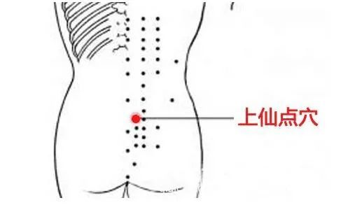 闪腰,慢性腰痛——上仙点"上仙点"位于第5腰椎正下方凹处,一面缓缓