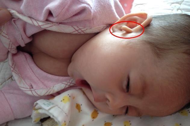 孩子出生100天我割掉了她的小耳朵拴马桩非福气别迷信