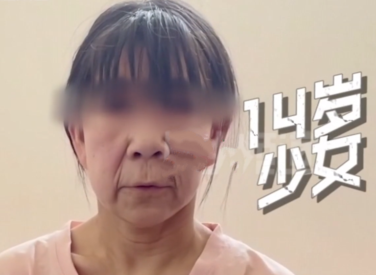 未老先衰河南14岁少女患病面容如古稀老人脸比50岁母亲还显老