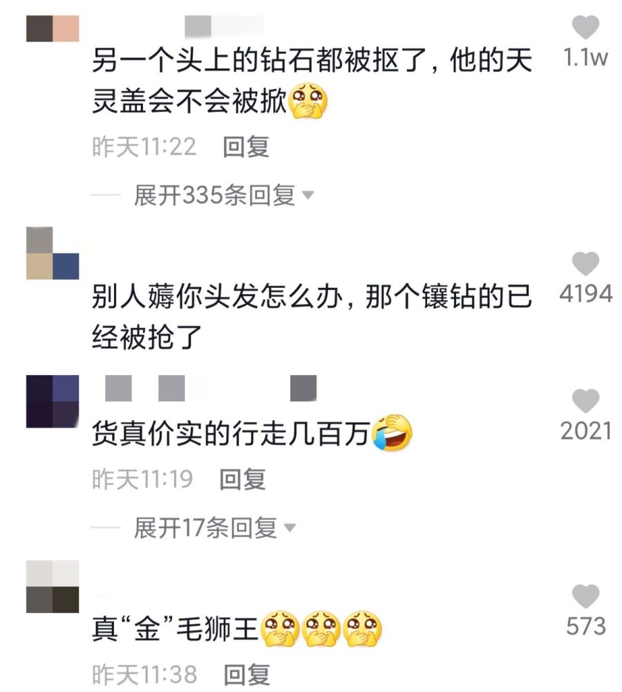 23歲男星動手術 將金鍊植滿頭皮當頭髮 網友 把幾百萬頂在頭上 中國熱點