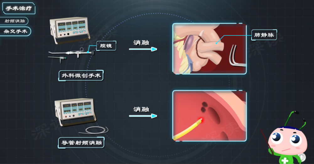 射頻消融雜交手術外科迷宮手術誰才能安全有效根治房顫