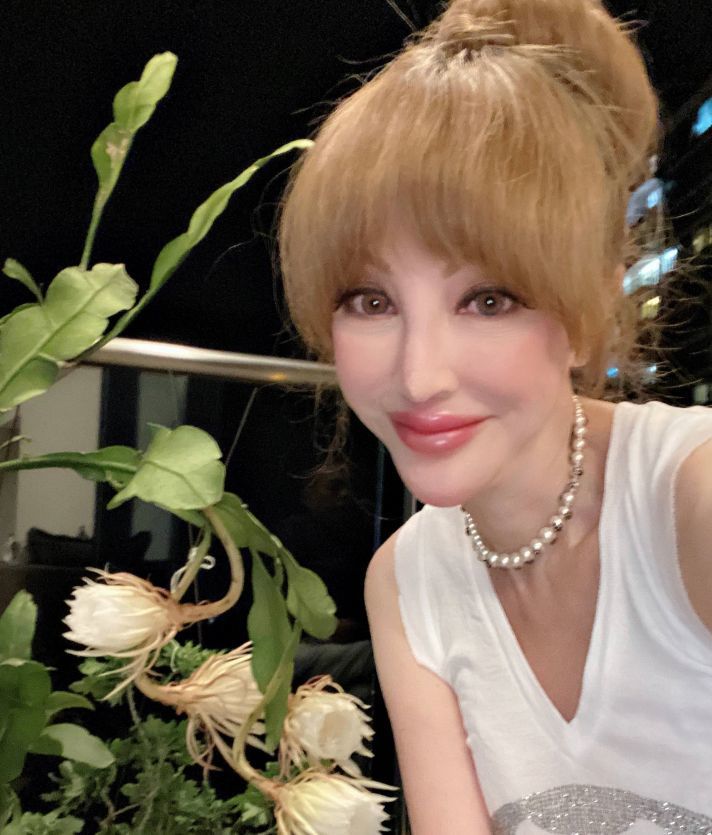 名媛薛芷伦遭遇车祸,脖子动弹不得太可怜,肇事司机逃之夭夭_腾讯新闻