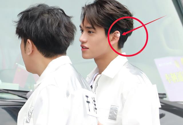 黄旭熙为何在耳朵上贴胶带不是受伤真正原因只有宋雨琦心疼