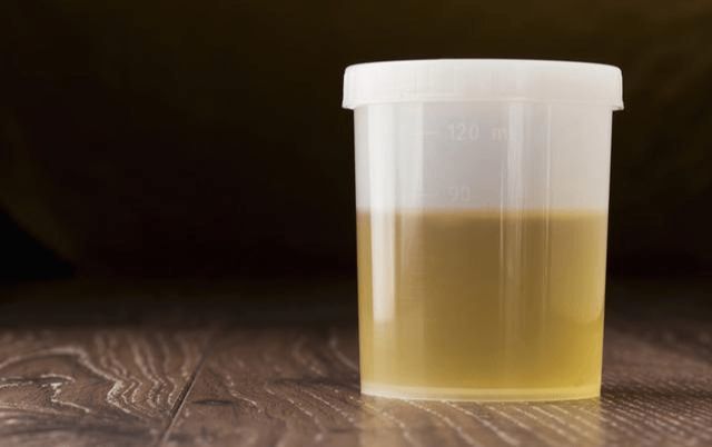 但是如果你发现,你的尿液的颜色比较深的话,那就说明体内的毒素无法