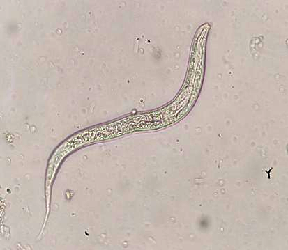 昨日"虫"现-在检验科养钩虫是一种什么样的体验?
