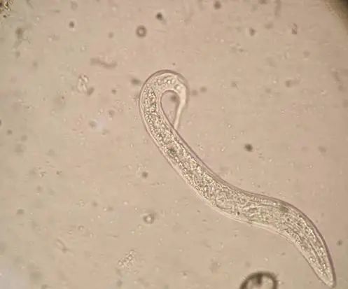 72小时内的生理盐水中见到的钩虫蚴虫5钩虫简介钩虫是钩口科线虫的