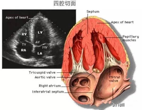 心脏彩超又称超声心动图,在没有任何损伤的情况下,医生通过超声了解