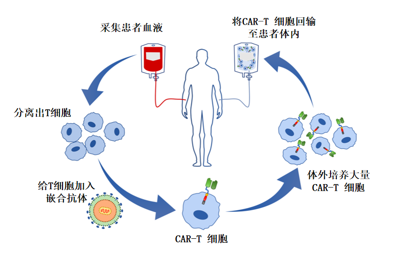 120万一针的cart疗法保险能报吗首例参与cart治疗的白血病女孩癌细胞