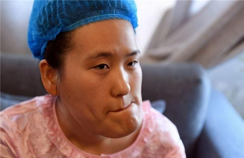 "歪脸女孩"赵宏秋:整容后变女神,放弃百万年薪到贫困地区当老师