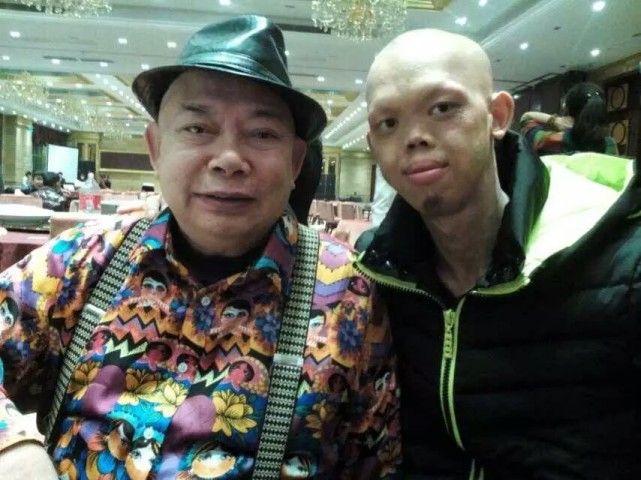 世界第一高人王峰军9年的特型演员身高高达2米55如今哪去了