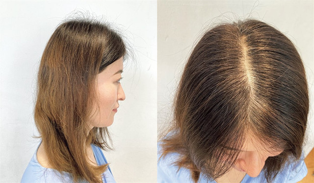 40 女人会有露头顶发旋困扰,8种方式来轻松遮盖,及