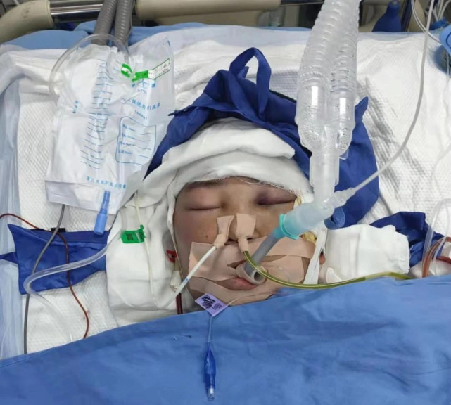 当时患者神志昏迷,伤情严重,医院随即开通绿色通道给予必要救治.