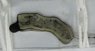 庆幸粪便管中还有一节孕节,不甘心失败,请教了粪便检验百家争鸣微信