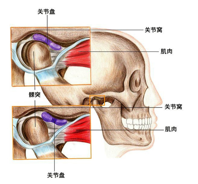 颞下颌关节紊乱病|关节盘|张大嘴|关节