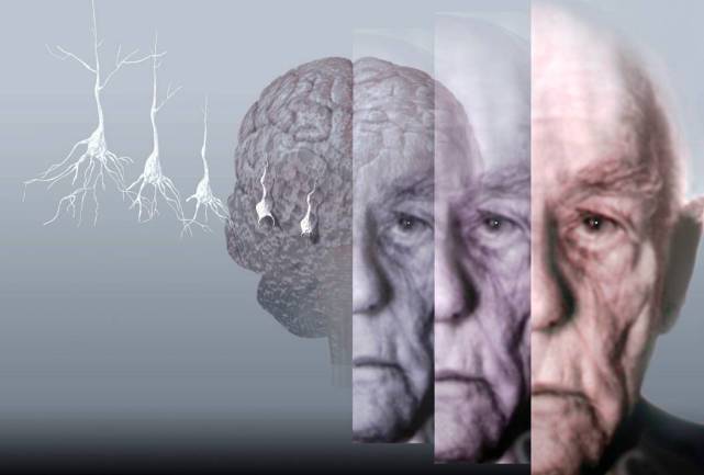 预防关口前移阿尔茨海默病老年痴呆预防与干预核心信息知多少