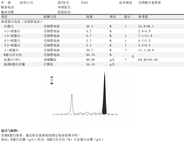 血清蛋白电泳结果如下:生化结果显示:球蛋白高达85.90g/l,胱抑素c:1.