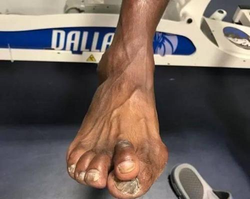 看了罗斯的膝盖科比的跟腱詹皇的脚趾还羡慕他们的高薪吗