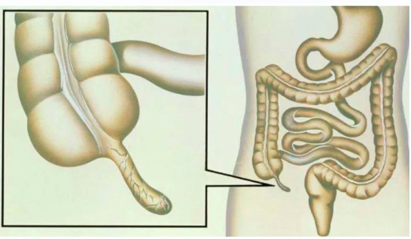 不住院不开刀不切除也能治好阑尾炎浦东这家医院就可以