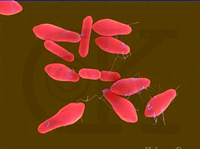 【创建国家卫生县城】密封腌渍食物中暗藏健康隐患,需谨慎防范_腾讯新