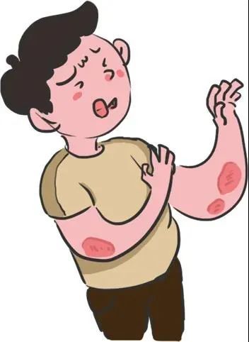 银屑病患者常用的"消字号药品"到底能不能治银屑病?|银屑病|国药准字