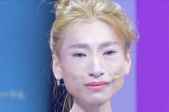 百万粉丝网红暴瘦,皮包骨头全脱相,娱乐圈明星过度减肥不可取