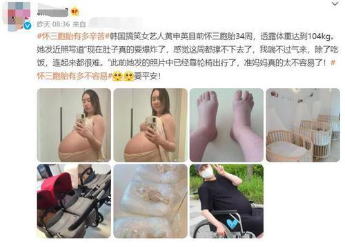 韓國女星懷三胞胎自嘲肚子要爆炸雙腳浮腫坐輪椅出行