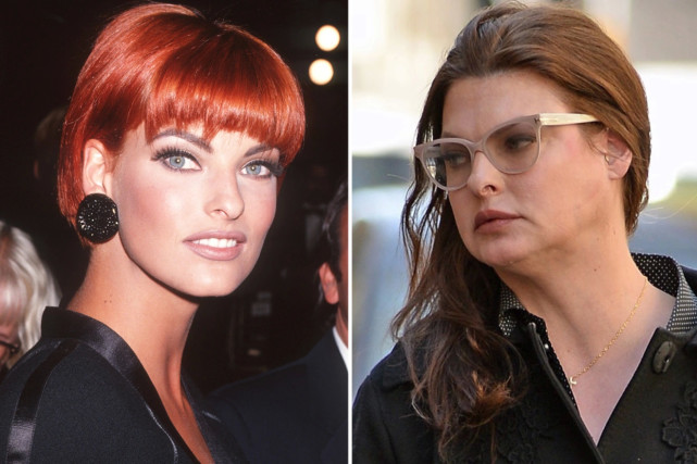 埃万杰利斯塔(linda evangelista)声称,一场整容手术导致她变得"畸形"