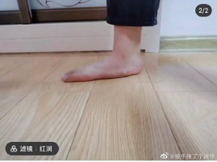 的可爱脚丫,然而,这些宝宝的脚丫无一例外都在外观上有扁平足的特征