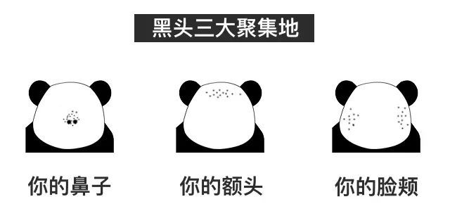 黑头1挤1个洞灭黑头有方法