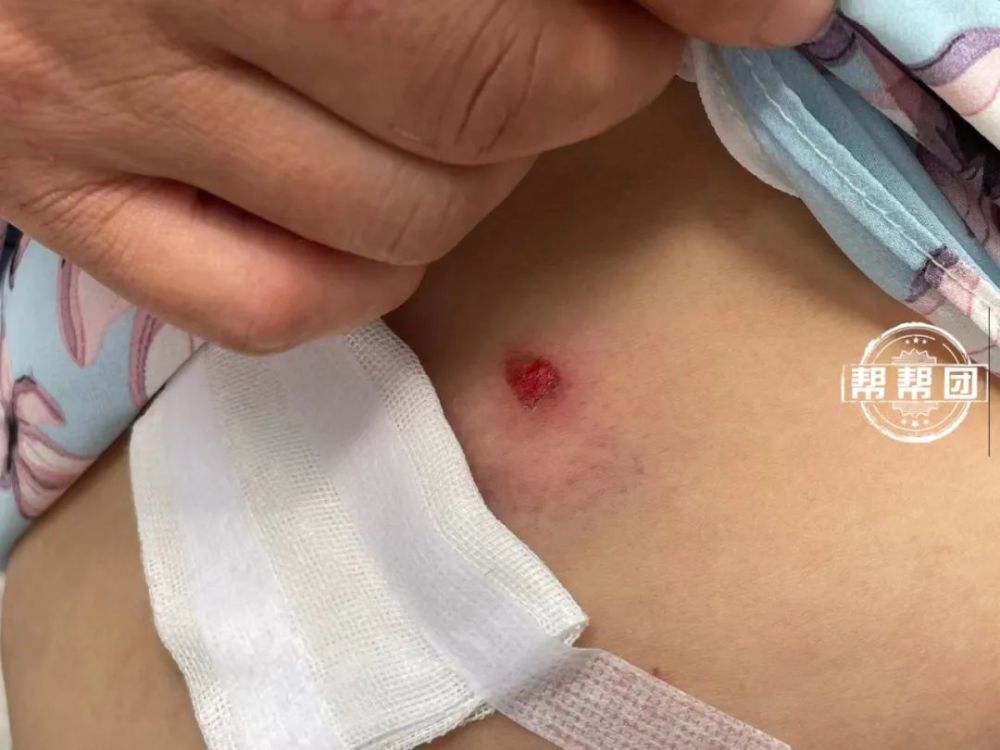 福州一市场多次遭钢珠袭击有商户腹部受伤