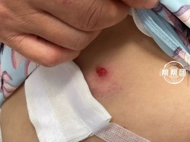 福州一市场多次遭钢珠袭击有商户腹部受伤