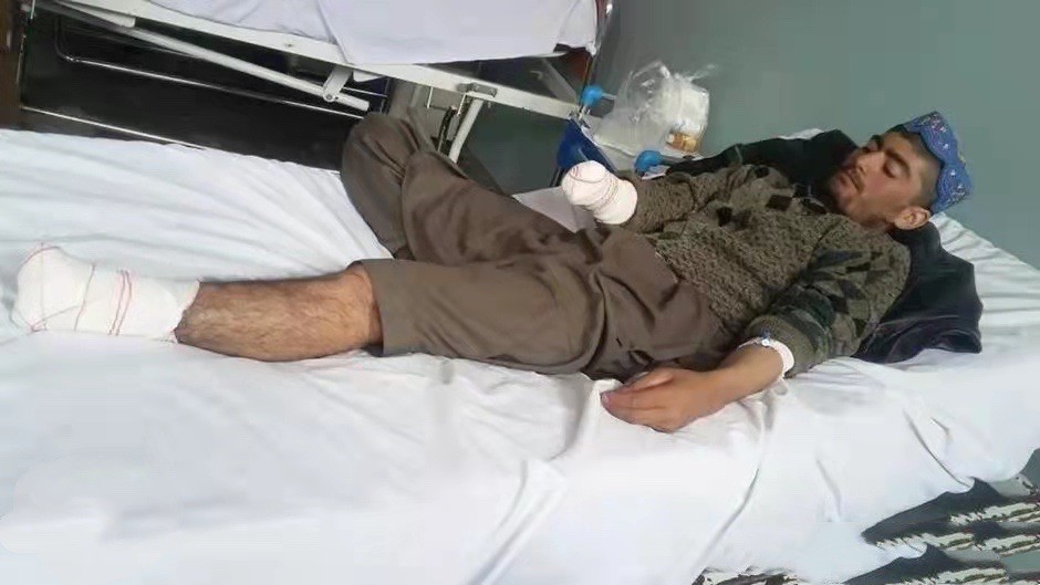 乱世用重典!塔利班对罪大恶极犯人砍手剁脚:警告全世界不要干预