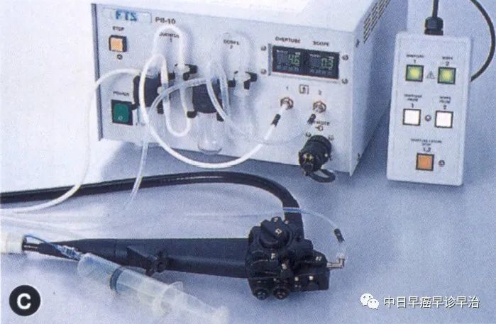 雙氣囊電子小腸鏡檢查法